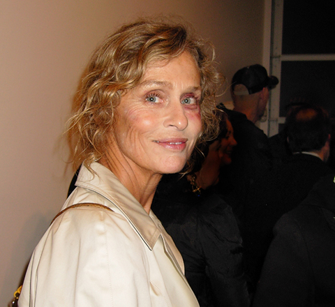 Lauren Hutton with a black eye