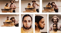 Untitled (Facial Hair Transplants), 1972–1979
