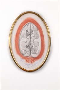 Cerebro de Pedro , 1967