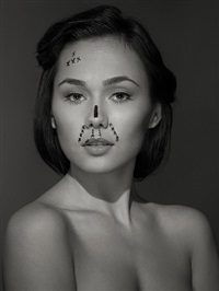 Patient O.L., age 22