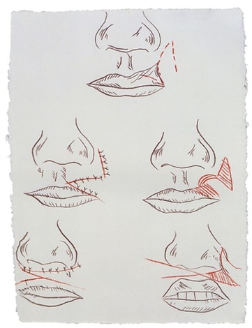 Andy Warhol, Cosmetic Surgery, 1985-1986. 